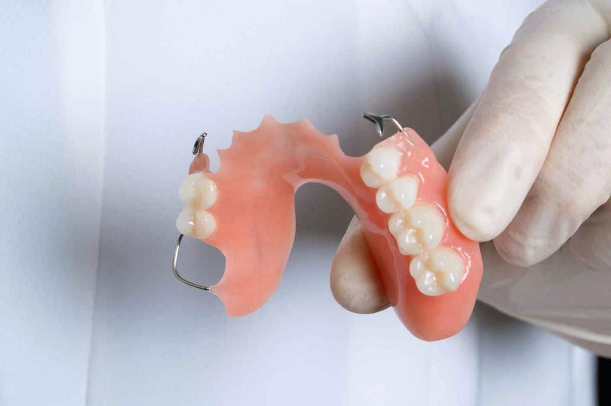 Partial Dentures